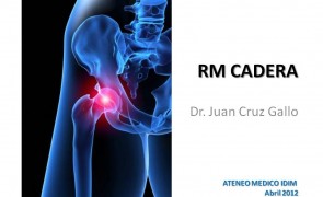 GALLO-IDIM1-RM Cadera GALLO-IDIM1-RM Cadera